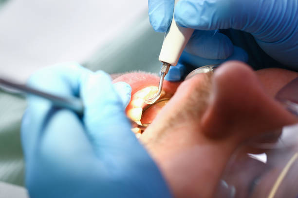 Best Weekend Emergency Dentist in Cajahs Mountain, NC